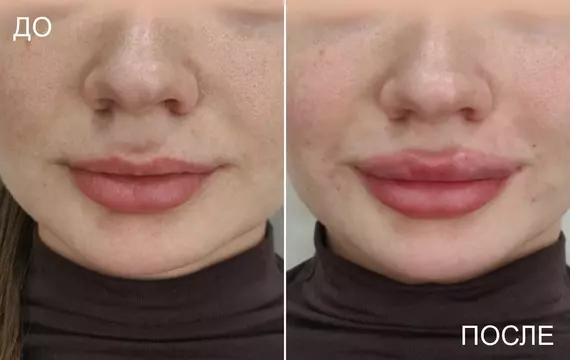 Результат 26